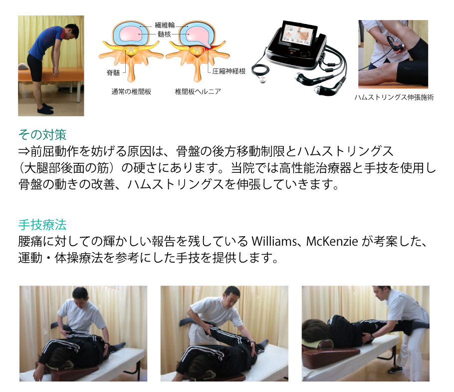 その対策⇒前屈動作を妨げる原因は、骨盤の後方移動制限とハムストリングス（大腿部後面の筋）の硬さにあります。当院では高性能治療器と手技を使用し骨盤の動きの改善、ハムストリングスを伸張していきます。 手技療法:腰痛に対しての輝かしい報告を残しているWilliams、McKenzieが考案した、運動・体操療法を参考にした手技を提供します。