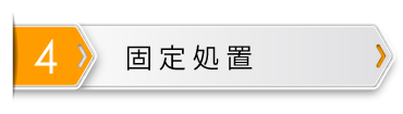 固定処置